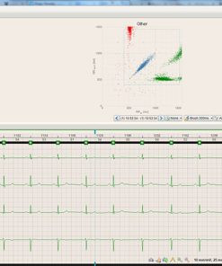 BTL_CardioPoint-Holter_H600_Poincare_graph_1448290690_original