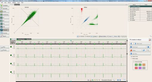 BTL_CardioPoint-Holter_H600_Poincare_graph_1448290690_original