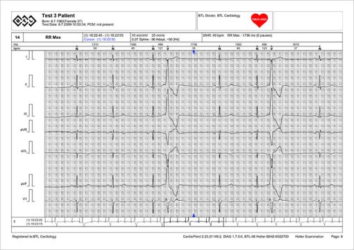 BTL_CardioPoint-Holter_Sample_report-ECG_strip_1448289474_original