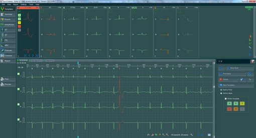 BTL_CardioPoint-Holter_Template_view-2_1448290630_original