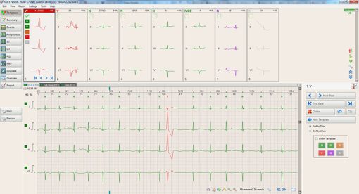 BTL_CardioPoint-Holter_Template_view_1448290939_original